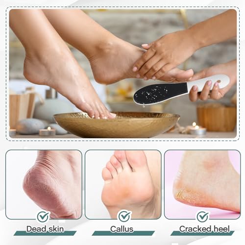 Lothee 30 Pack Foot File Foot Callus Remover Double Sided Professional Sandpaper Pedicure Tool Feet Scrubber Sander Feet Rasp for Dead Skin Cracked Heel Women Manicure Beauty Spa, 100/180 Grit, White