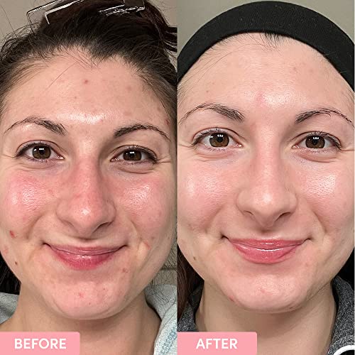 Sand & Sky Hyaluronic Acid Serum for Face - Hydrating Serum with Probiotics & Fermented Sea Kelp, Face Serum for Fine Lines, Plumps Skin & Minimizes the Appearance of Wrinkles, 1 fl oz