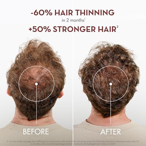Klorane Strengthening Shampoo with Quinine - Dermatologist-Tested - Natural Alternative Thickening Shampoo for Hair Thinning - Support Stronger, Healthier Hair for Men & Women - 13.5 fl. oz.