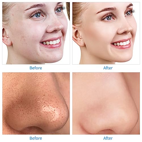 Gerovital H3 DERMA+ PREMIUM CARE Smoothing Face Serum ? Hydrating and Firming Formula for Mature Skin, 15ml