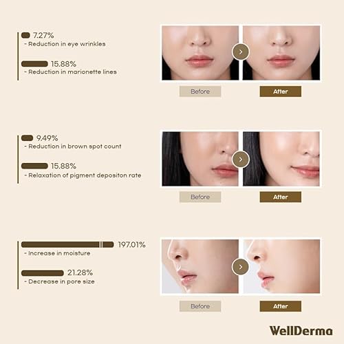 WELLDERMA Sapphire Collagen Impact Hydrogel Fitting Mask, 25g x 4 Sheets ? Hydrating & Firming Micro-Hole Sheet Mask with Collagen Water 850,294ppm, Niacinamide & Peptides