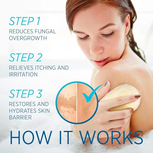 Roycederm Tinea Versicolor Relief Soap: Tea Tree Oil & Sulfur Cleansing Bar, Soothes Irritation, Hydrates & Supports Skin Health