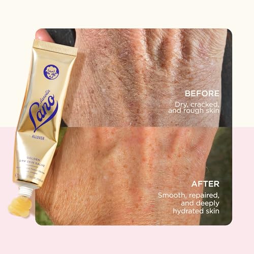 Lanolips Golden Dry Skin Salve - Lanolin Oil Healing Ointment with Vitamin E & Manuka Honey - Body Moisturizer for Dry Skin - Relief for Dry Hands & Cracked Lips - Dermatologist Tested (25g)