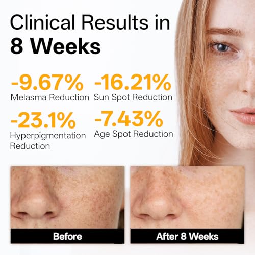 WNP Vitamin C Serum for Face - Dermatologist Tested Anti-Aging & Brightening with Hyaluronic Acid & Vitamin E, Treatment for Dark, Age, Sun Spot, Melasma, Hyperpigmentation, Fine Lines & Wrinkles