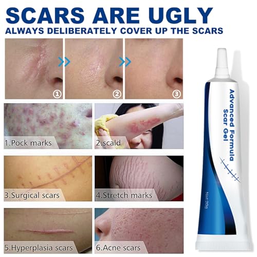 Advance Scar Gel, Scar Cream, Advanced Formula Scar Gel for Old & New Scars, Surgical Scars, Face, Body, Leg, Burns, Acene, C-Section, Stretch Marks, Keloids, Scar Removal for Adults & Kids