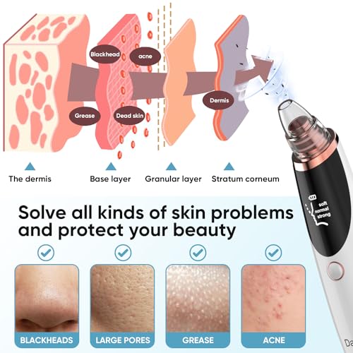 Blackhead Remover Pore Vacuum for Face & Nose ? Deep Cleansing Blackhead Remover Tools with 3 Suction Levels, 5 Replaceable Tips, USB Rechargeable Pore Cleaner