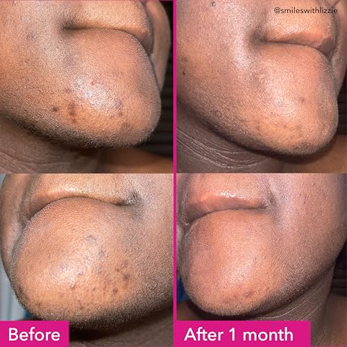 Meebak Cica Cream | Daily Moisturizer for Soothing, Repairing, & Firming with Niacinamide, Peptides, & Retinol | Deep Hydration for Glass Skin | Korean Skin Care