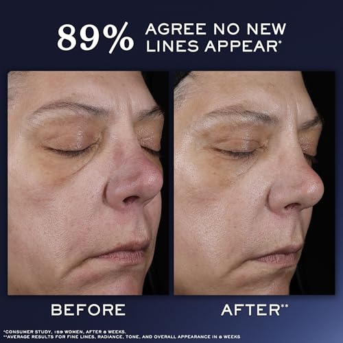 Lanc?me G?nifique Ultimate Dual Recovery Face Serum- Anti-Aging Serum Visibly Improves Fine Lines, Rough Texture, Plumpness and Even Skintone - with Beta Glucan and, Hyaluronic Acid