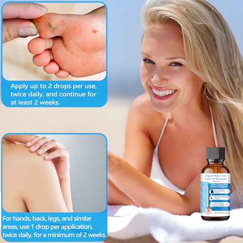 Fast Acting Wart Corn Callus Remover, Wart Remover Freeze Off with Salicylic Acid for Plantar Wart, Corn Freeze Off for Men and Women 30 ML.