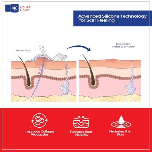 GauzeCare Silicone Scar Tape ? 1.6¡±x120¡± Roll ? Medical-Grade, Reusable, Professional Silicone Scar Tape for surgical scars, C-Section, Burns, Keloid, and Acne Scars