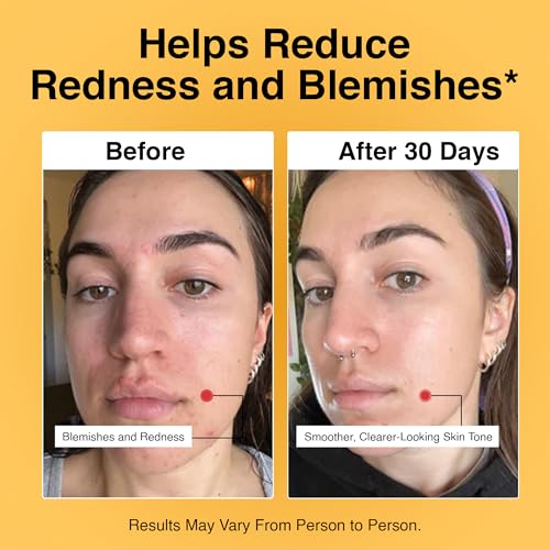 Foundation Skincare Azelaic Acid for Face 14% (1 Fl Oz) ? Dermatologist Formula for Uneven and Blemish-Prone Skin, Supports Balanced Tone & Smooth Texture for Men & Women