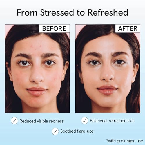 grace & stella Hypochlorous Acid Spray for Face - Acne Spray - Gentle Face Mist to Calm Redness, Flare-Ups, Breakouts, Body Acne, Bacne - Soothing Facial Mist for Sensitive Skin (120ml/4 fl oz)