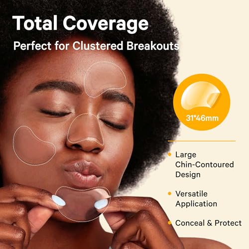 Sosky Chin Pimple Patches Hydrocolloid Acne Patches for Breakouts Large Spot Control Covers for Face Chin & Body with Tea Tree & Calendula Oil Vegan Cruelty Free (10 Count)