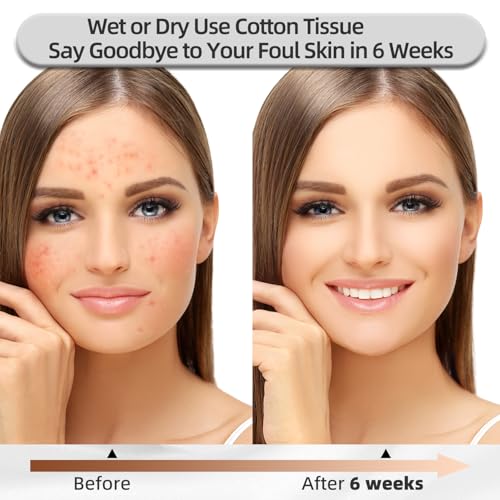 Disposable Face Towels, 10"¡¿12", Ultra Thick Facial Towelettes Disposable, Soft Single Use Face Towel, 100% Biodegradable Makeup Remover Dry Wipes, 1 Pack