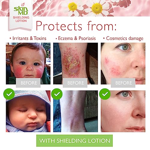 Skin MD Shielding Lotion Hydrating Body Lotion for Sensitive Skin with Dispenser | Non-Greasy, Fast-Absorbing Moisturizer with Plant-Based Ingredients, Eczema & Psoriasis Relief - 4oz 3-Pack