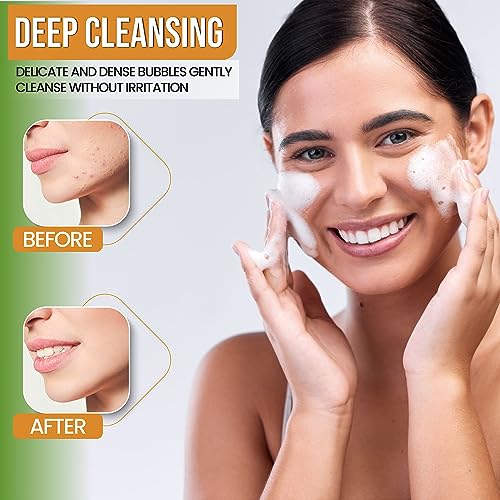 AMVital Turmeric Skincare Bundle ? Cleanser, Toner, Cream & Serum for Radiant, Even-Toned Skin