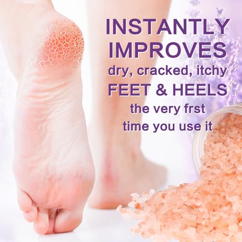 4 Pack Foot Soak Salts Kit Himalayan Pink Salt Tea Tree Oil Lavender rose Pure Epsom Salt Soak Pedicure Salt Softens Calluses & Soothes Foot Care Gifts for Mom women
