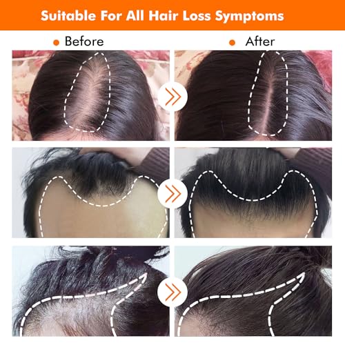 Hair Growth Kit, Biotin Hair Growth Oil Serum, Hair Scalp Massager Helps absorb Hair Growth Oil Serum
