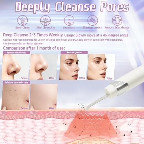 Multifunctional Facial Spatula Pore Cleaner Tool for Deep Cleansing£¬Serum Infusion£¬ Skin Lifting£¬Pore Cleansing with Timer Function for Facial Skincare Gift Remov