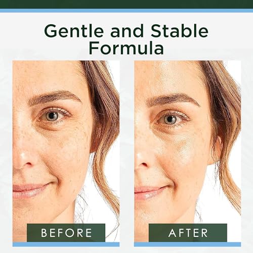 Tree of Life Beauty Hyaluronic Acid Serum, Skin Brightening Face Oil for Dark and Age Spots, Facial Serums for Dry and Sensitive Skin Care with Vitamin E for Soft Smooth Skin, 2 Fl Oz (Pack of 3)