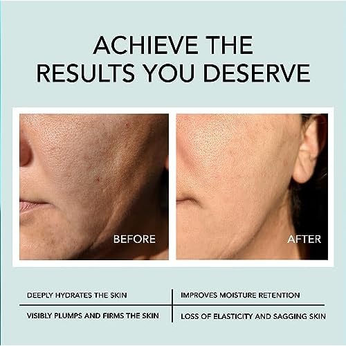 Go Beauty Triple Hyaluronic Acid Hydrating Serum ? Hydrate, Soothe & Plump ? Collagen, Vitamin B5 & 7 Peptide Complex for Dry & Aging Skin, 1 fl. oz