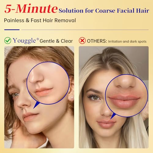 5 Min Facial Hair Removal For Women with Soothing Cream, Painless & Gentle Sensitive Skin Hair Removal Cream for Chin & Upper Lip & Cheeks (4.06 Fl Oz)