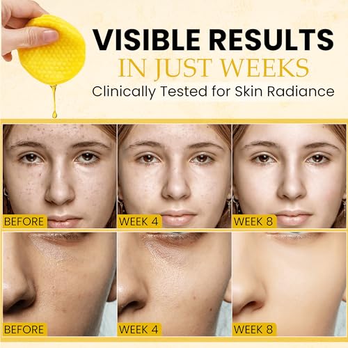 Turmeric Kojic Acid Cleansing Pads For Face Exfoliating And Dark Spots, 80pcs, Brightening, Balance and Moisturize Skin, with Vitamin B, Retinol, Prickly Pear, Olive Oil, Gentle For All Skin Types