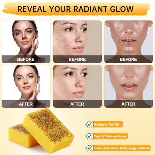 Kojic Acid Soap, Lemon Turmeric Soap Bar with Vitamin C for Dry Sensitive Skin, Turmeric Bar for Face, Body Hands 2 Bars