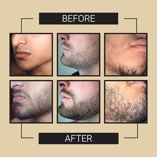 Crafted Beards Beard Growth Oil Serum - 1 fl Oz - Unscented - Helps Grow A Thicker Beard, Improves Beard Health, Fills in Thin and Patchy Spots - (1 Pack)