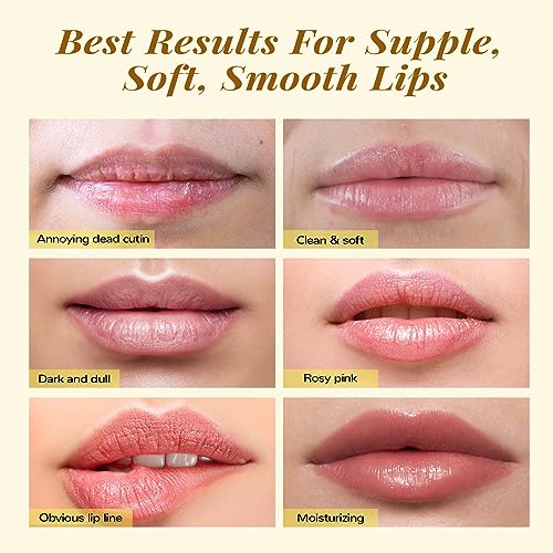 ANAI RUI Lip Care Kit, Lip Sugar Scrub Set, Lip Sleeping Mask & Lip Exfoliator Scrub, Overnight Lip Treatment, Lip Scrub For Dark Lips & Moisturizer for Dry, Chapped, Cracked, Lips, Turmeric