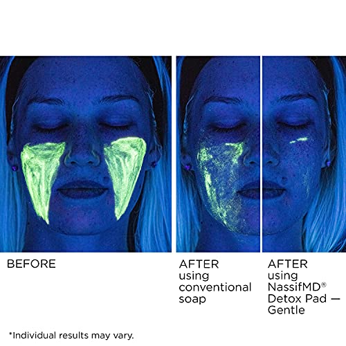 NassifMD Gentle Detox Pads, Surgeon-Created Fruit Acid Complex for Sensitive Skin, Brightens, Exfoliates & Reduces Wrinkles, Dermatologist-Tested
