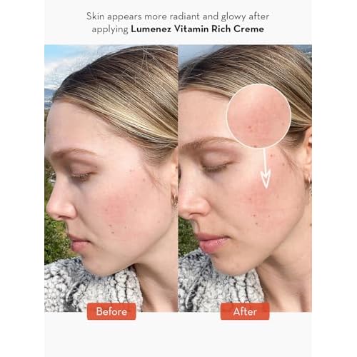 SONAGE Lumenez Vitamin Facial Cream: Daily Restorative Moisturizer with Vitamin C | Hydrating Cream for Dry Skin