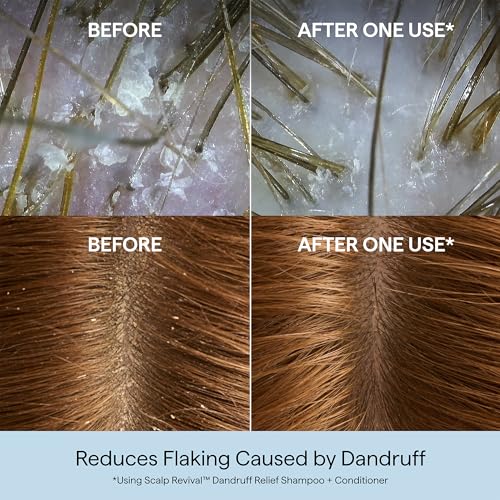 Briogeo Scalp Revival Dandruff Relief Conditioner | Charcoal + 1.8% Salicylic Acid | Daily Anti-Dandruff Conditioner for Flakes, Itch & Irritation | Color-Safe | Vegan & Cruelty Free | 8.4 oz