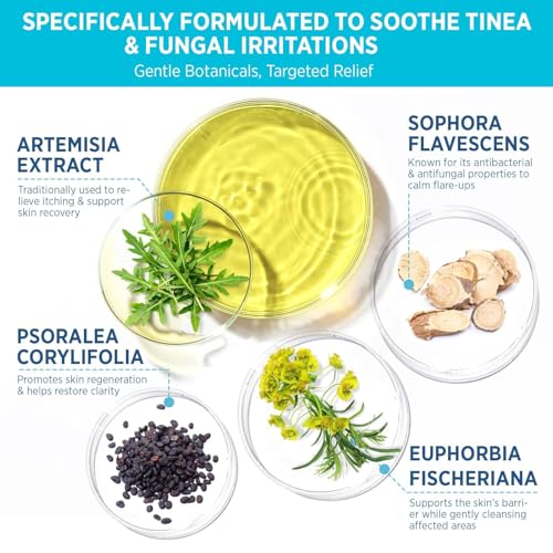 Tinea Versicolor Relief Cream & Soap Kit - Helps with Tinea Versicolor, Fungal Skin Conditions ? Soothes, Cleanses, and Restores Skin Health