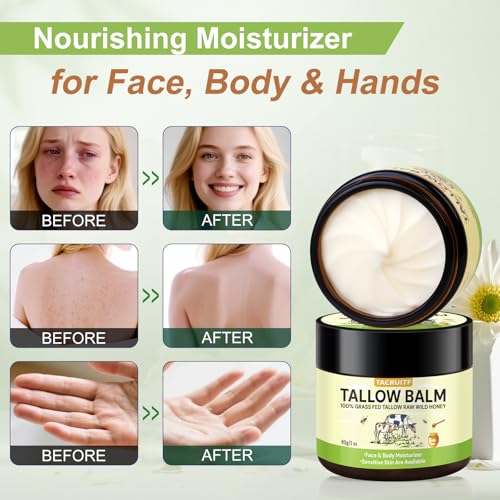 Organic Grass-Fed Beef Tallow & Raw Honey Balm ? Handmade Whipped Moisturizer for Face & Body, Soothes Eczema, Rosacea, Dry & Sensitive Skin ? Unscented, All-Natural, Chemical-Free (6 Packs / 12oz)