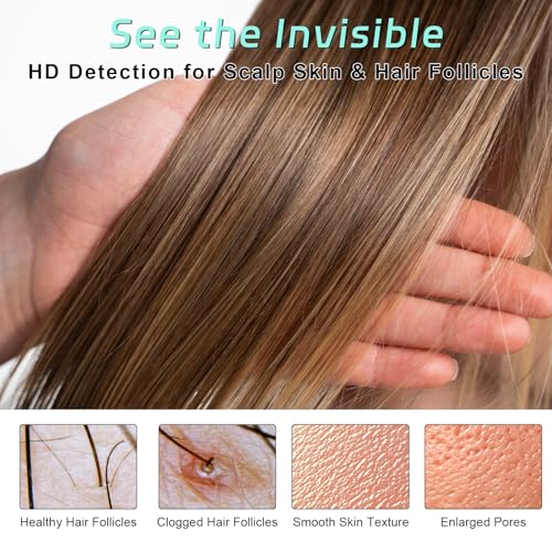 At-Home Skin & Scalp Analyzer - 2MP 1000X Wireless HD Microscope to Inspect Pores, Wrinkles & Hair Follicles, Connect to Your Phone or PC, Personal Beauty Magnifier for Home & Salon Use