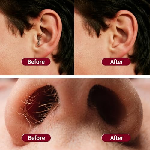 Galdino Nose Wax Kit Men & Women, Nose Hair Wax Kit With 30 Sticks, Ear Hair Removal, Nose Waxing Kit Easy, Quick and Painless