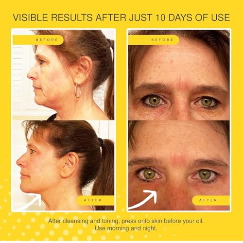 Jojoba Ultimate Serum - Anti-Aging - Reduces Appearance of Wrinkles, Crow?s Feet, Frown Lines & Fine Lines - Visibly Increases Skin Firmness - Hydrates & Tightens - 30ml