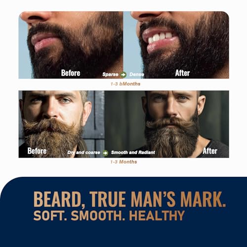 Biotin Beard Growth Kit for Men with Conditioning Oil and 0.25mm Massager Roller, Sandalwood Serum with Castor and Jojoba Oil, Grooming Softer Thicker Healthier-Looking Mustache Beard Care