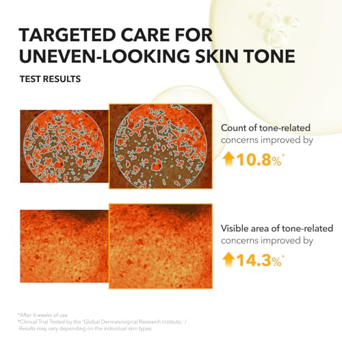 APRILSKIN A.C.E Serum£üVita Kojic Serum for Brightening & Glow£ü3-Second Brightening£üKojic Acid & Vitamin C for Uneven Skin Tone£üKorean Skin Care£ü3.88 oz.