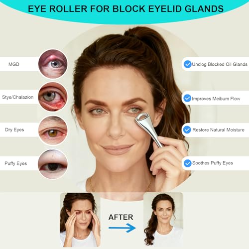 Gentle Metal Eye Roller For Blocked Eyelid Glands,Eyelid Massage Wand For Improves Meibum Flow & Unclogs Oil Glands,Relieve Chalazion,Stye,Dry Eyes,And Mgd,Soothe Puffy Eyes
