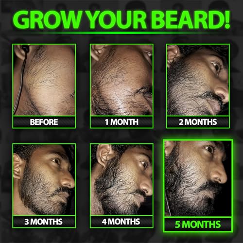 Beard Growth Kit w/GROW XXL Beard Serum for Maximum Facial Hair & Conditioner + GROW 11-in-1 Mens Shampoo & Conditioner (Hair Growth Shampoo for Men w/Biotin) - Formulated in America