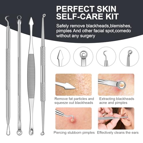 Pimple Popper Tool kit Blackhead Remover Comedone Extractor Kit with Box for Easily Remove blackheads, Acne, Blemishes, Whiteheads, pimples and Papules from The face and Bonus Gift -11pcs