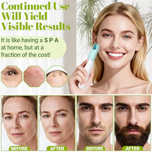 Derma Roller, TUMAKOU 10 in 1 Microneedle Roller Set for Face, Body, Scalp, Beard Hair, Microneedling Micro Needling Roller Kit for Women Men, with Storage Case & Face Ice Roller & Facial Brush(Green)