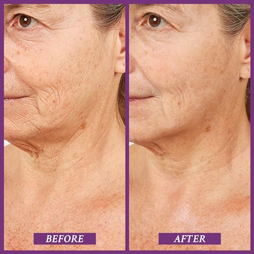 PRAI Beauty Ageless Throat & Decolletage Serum for Instantly Ageless Neck | Neck Firming and Tightening Serum | Anti-Aging Serum that Shields Skin from Damage and Improves Skin Tone + Colour | 4 Oz