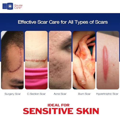 GauzeCare Silicone Scar Tape ? 1.6¡±x120¡± Roll ? Medical-Grade, Reusable, Professional Silicone Scar Tape for surgical scars, C-Section, Burns, Keloid, and Acne Scars