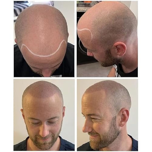 Nuva Scalp Micro-Pigmentation Ink - Customizable, Neutral Undertone for SMP Procedures, Vegan, Made in USA (Dark Brown)