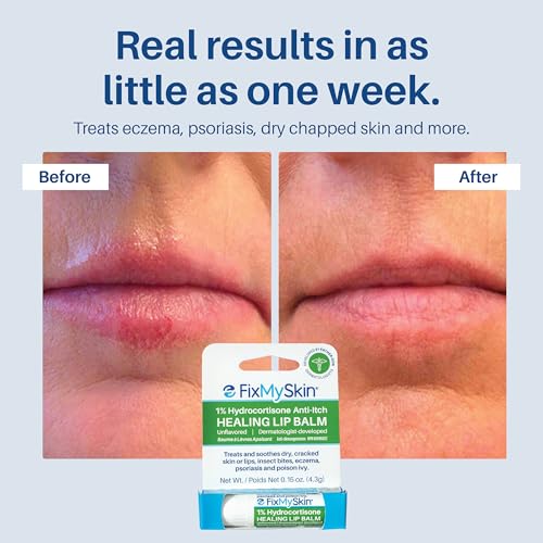 FixMySkin 1% Hydrocortisone Healing Lip Balm, Unflavored ? Soothes Dry, Cracked & Irritated Lips, Relieves Chapped Lips, Cold Sores & Eczema, Dermatologist Developed, Travel-Friendly Tube, 0.15 oz