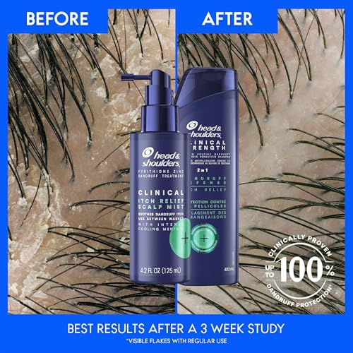 Head & Shoulders Dry Scalp and Dandruff Treatment Kit, Clinical Strength Shampoo and Conditioner Plus Clinical Itch Relief Mist with Menthol, for Scalp Relief Between Washes, 13.5 oz and 4.2 oz