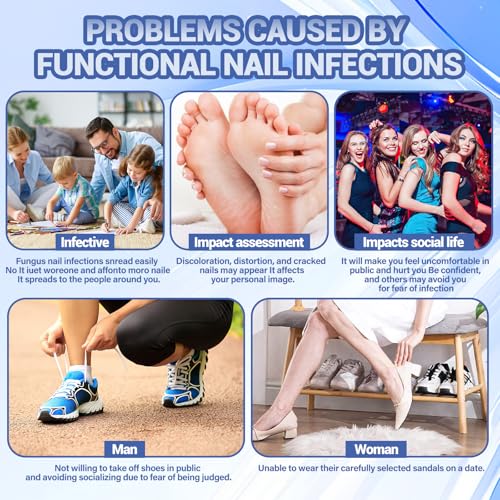 Toenail Fungus Treatment Extra Strength, Ingrown Toenail Treatment, 80 Pcs Glue-Free Breathable Corrector Patches, Professional Ingrown Toenail Tools, Not Prone to Falling Off, with File
